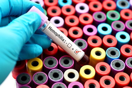 Día Mundial de la Hemofilia: Los pacientes con hemofilia reclaman más conocimiento y acceso universal a los mejores tratamientos.
