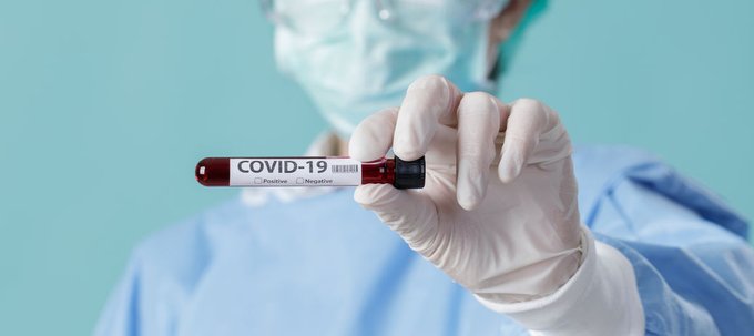 Informe Comisión Asesora COVID-19-OMC sobre pruebas diagnósticas masivas a poblaciones: “No aportan valor sanitario y suponen un uso ineficiente de los recursos públicos”.